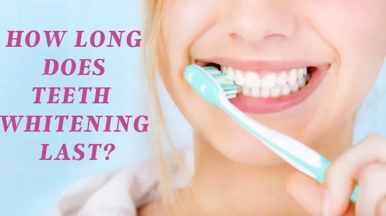 How Long Does Teeth Whitening Last? Updated 2022
