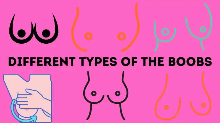 Classification of Women’s Breast Types Based on Anatomy and Shape